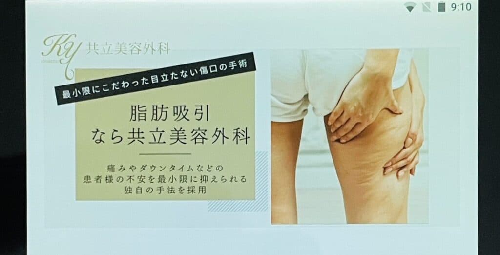 共立美容外科 脂肪吸引